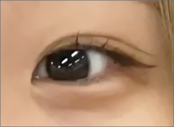 カラコン moon-kake-before