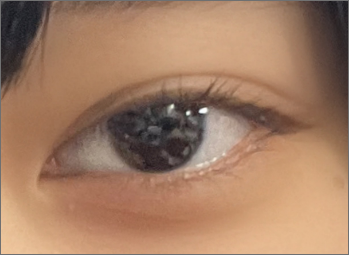 カラコン raspberry-before